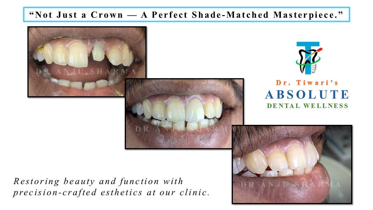 Smile Transformation 3